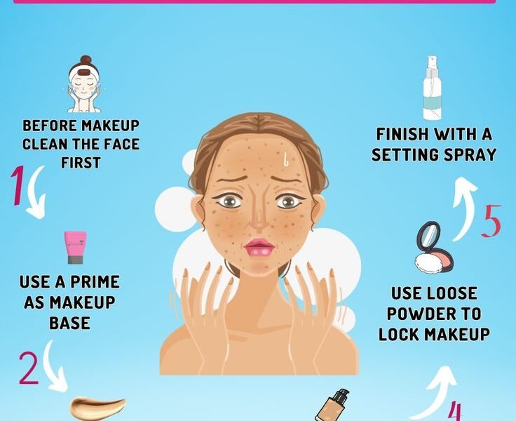 Makeup Techniques for Acne-Prone Skin