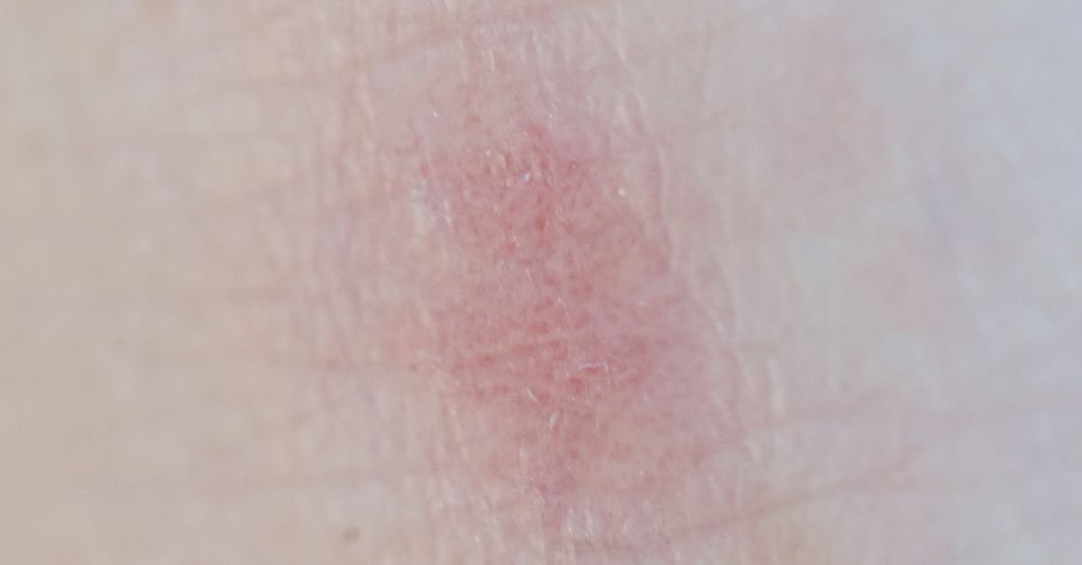 Inflammation-Calming Botanical Skin