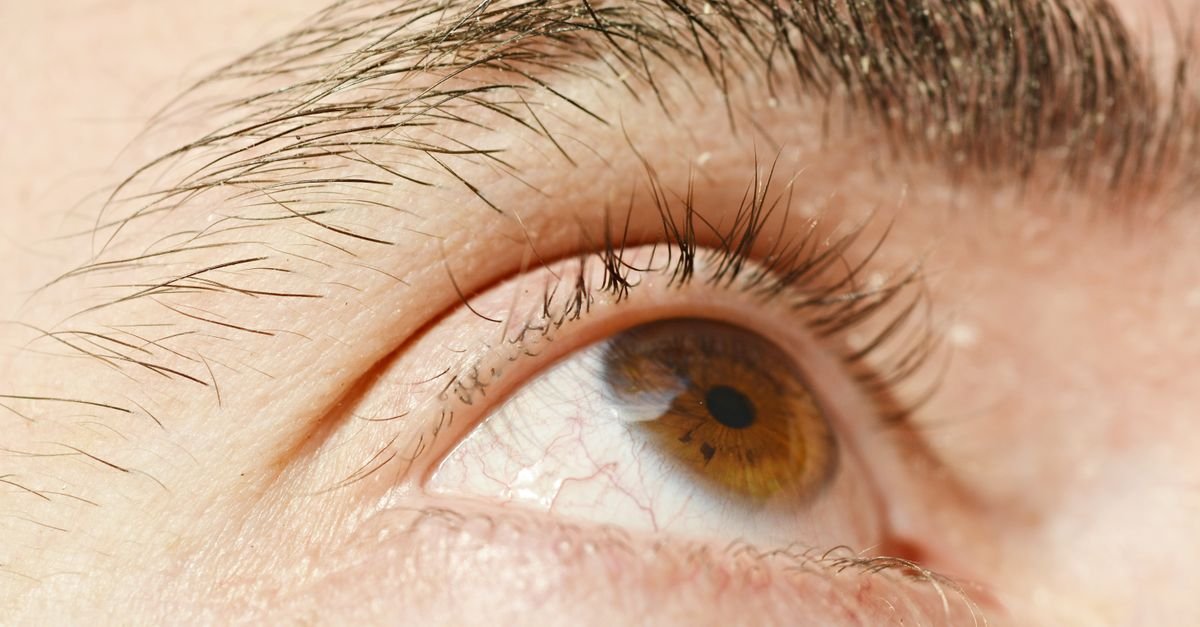 Detailed close-up of the skin around an eye