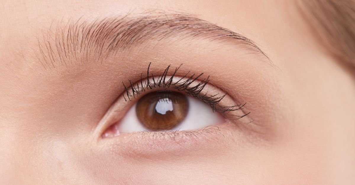 The thin skin under the eyes shows dark circles easily