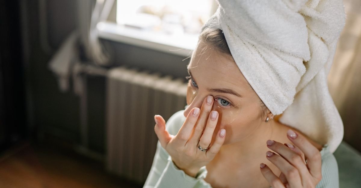 At-home care for dark circles under the eyes