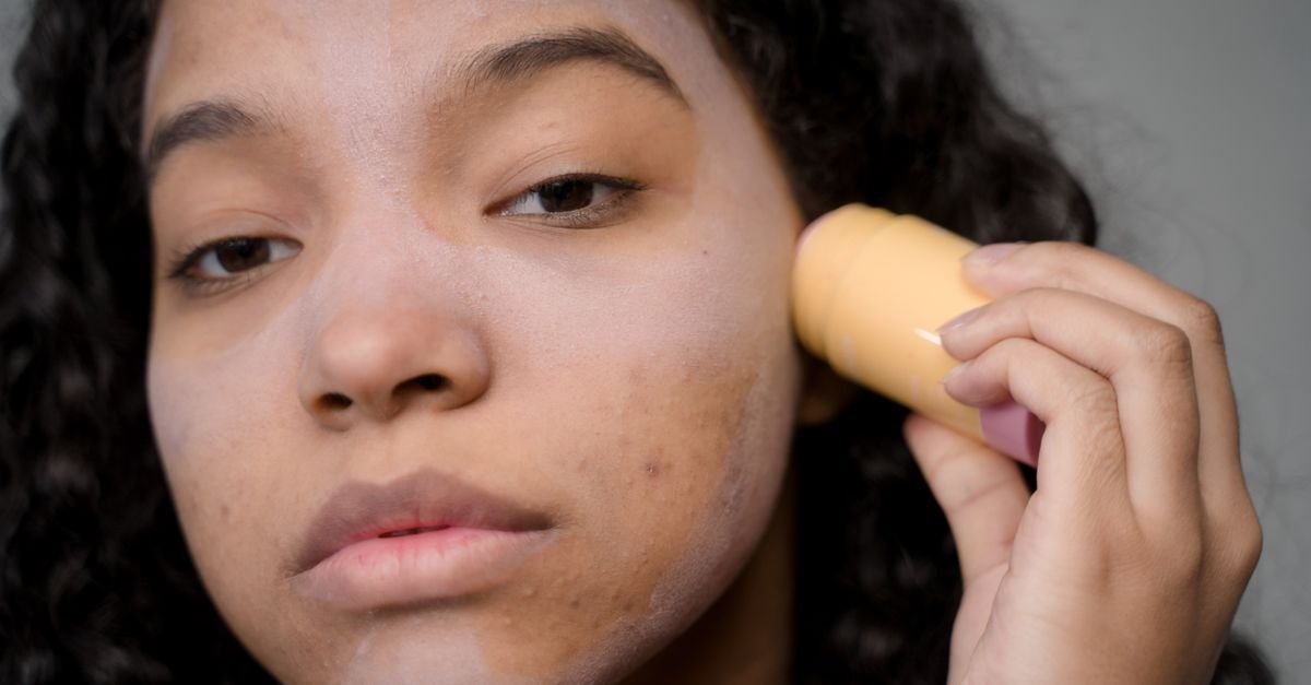 Close-up of skin with small blemishes being examined